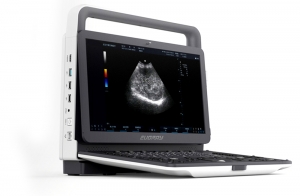 УЗИ аппарат портативный EVORAY USP 70